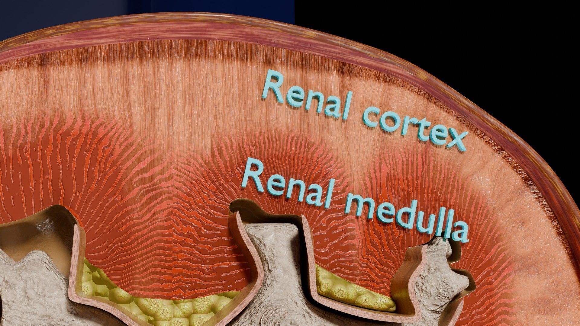 Kidney stone nephrolithiasis Staghorn calculus Low-poly 3D model_4