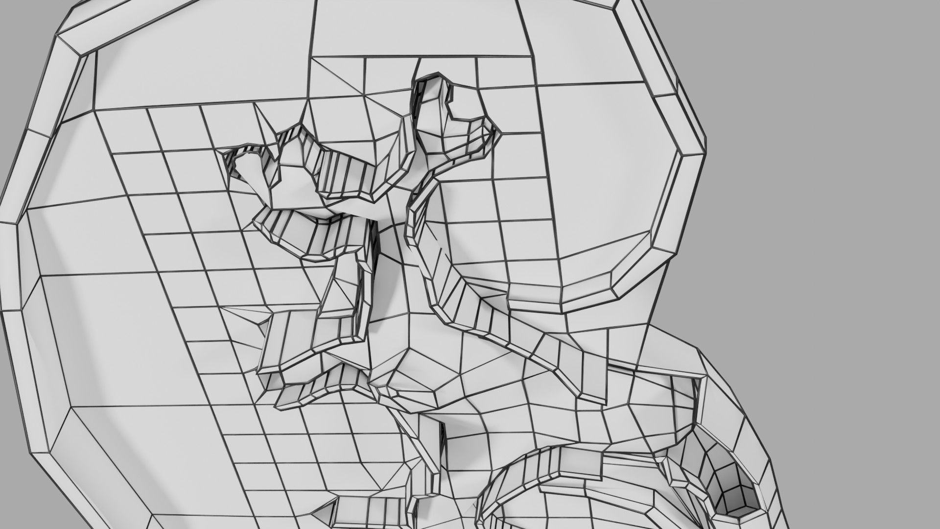 Kidney stone nephrolithiasis Staghorn calculus Low-poly 3D model_28