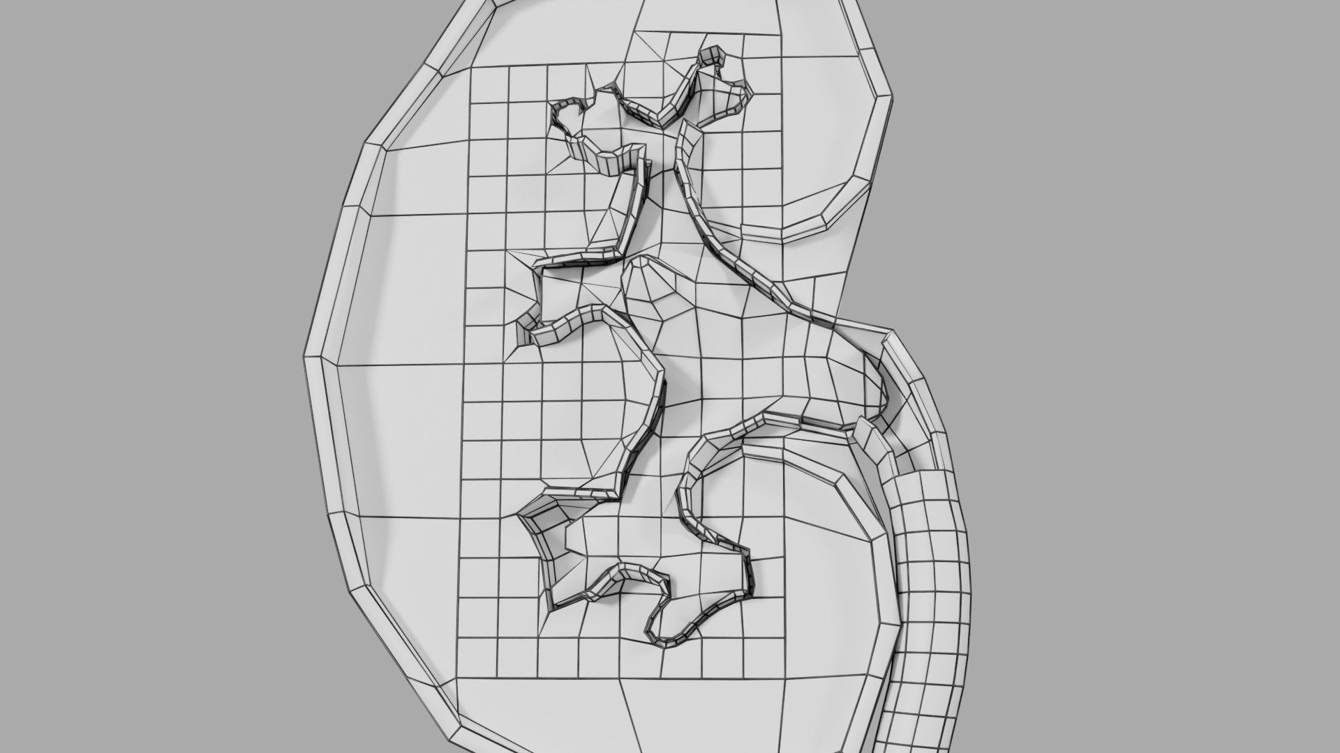 Kidney stone nephrolithiasis Staghorn calculus Low-poly 3D model_23