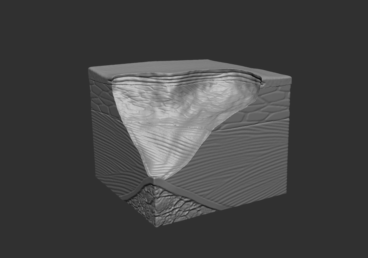 Skin ulcers 3D print model_3