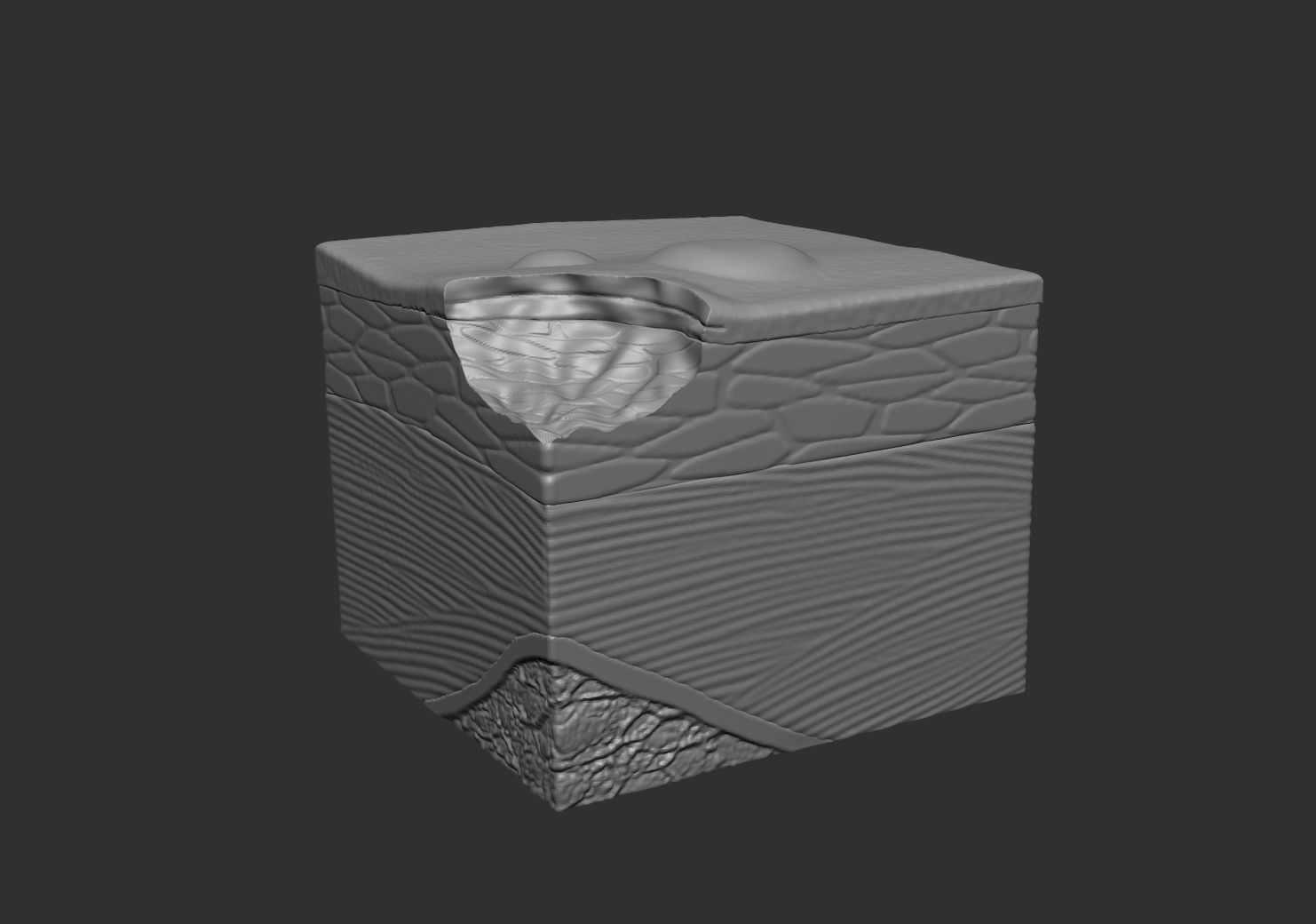 Skin ulcers 3D print model_1