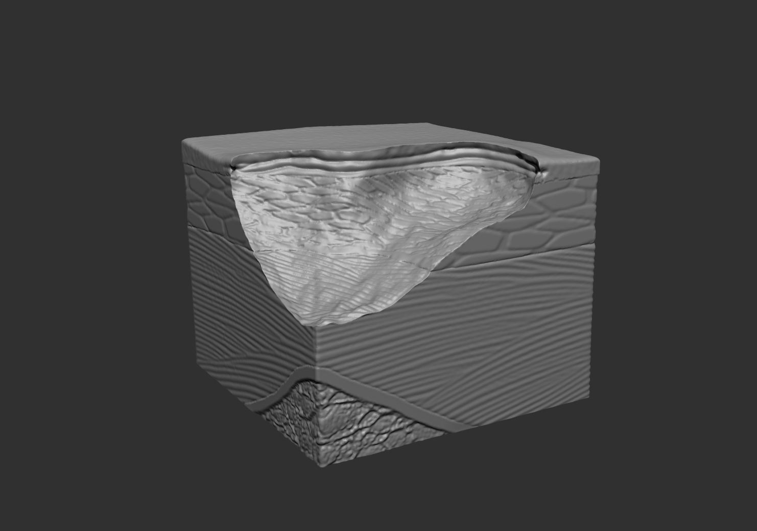 Skin ulcers 3D print model_2