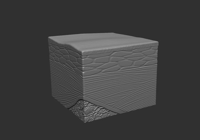 Skin ulcers 3D print model