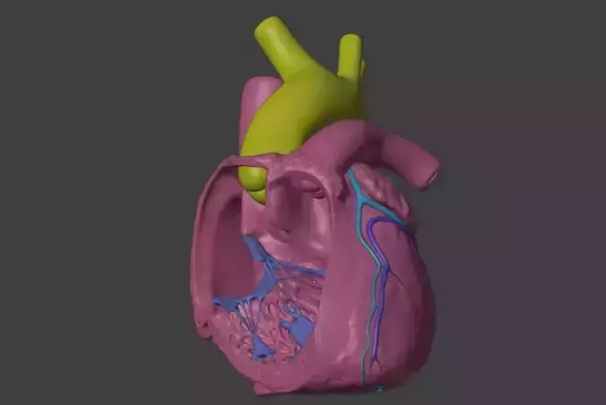 3D Model of Heart with Double Outlet Right Ventricle 3D print model
