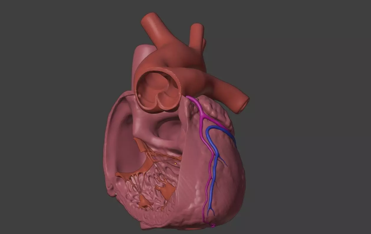3D Model of Heart with Truncus Arteriosus 3D model_0