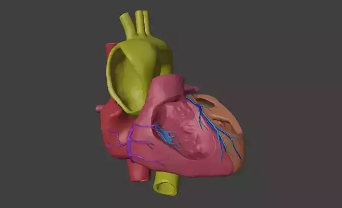 3D Model of Heart with Bicuspid Aortic Valve - BAV
