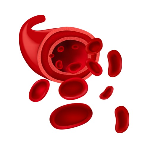 3D Model of Artery with Atherosclerosis Low-poly 3D model_6