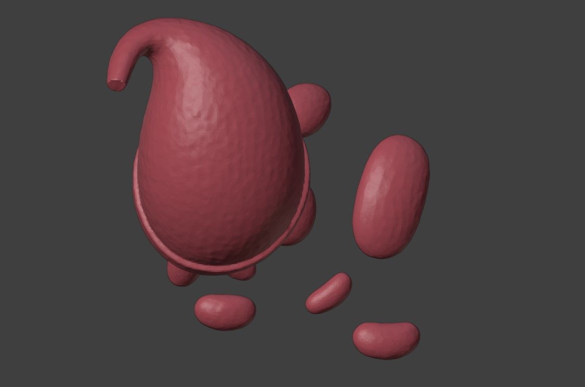 3D Model of Artery with Atherosclerosis Low-poly 3D model_2