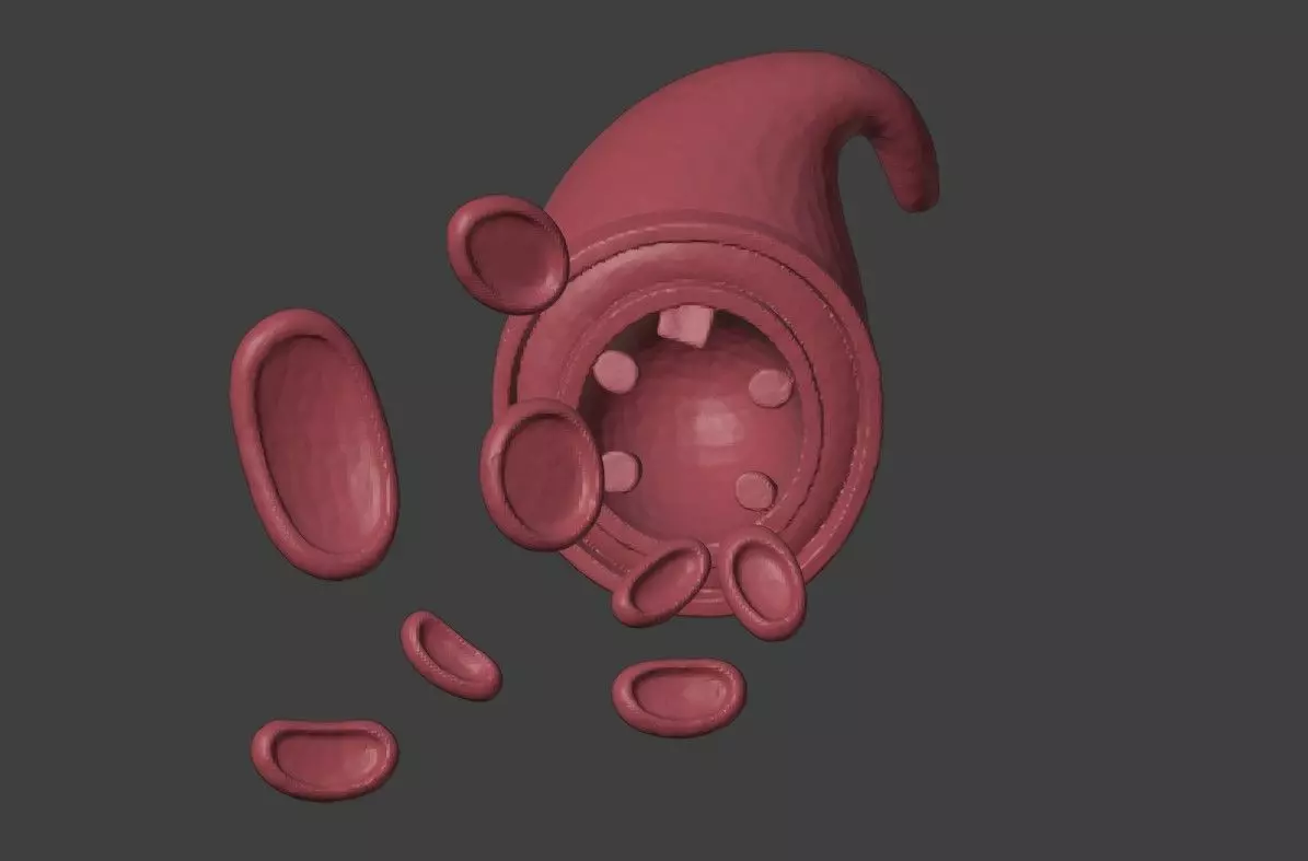 3D Model of Artery with Atherosclerosis Low-poly 3D model_0