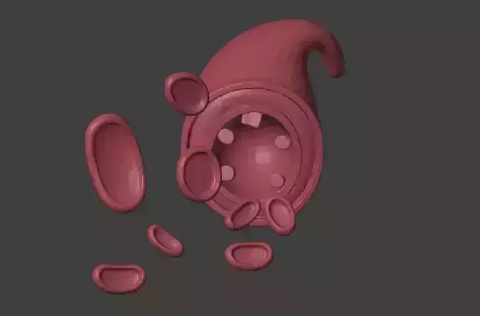 3D Model of Artery with Atherosclerosis Low-poly 3D model