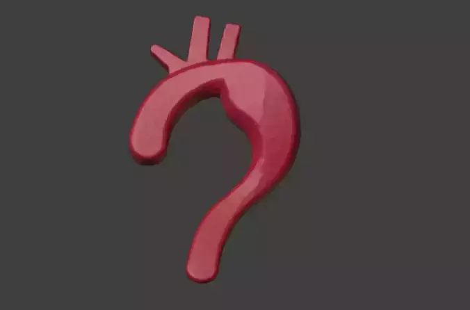 3D Model of Aorta with Aneurysm 3D model