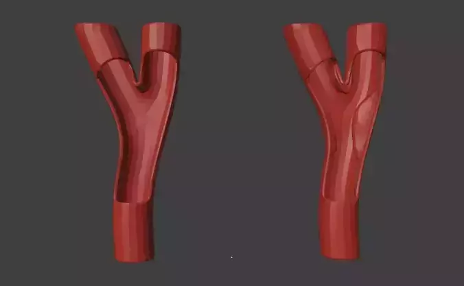 3D Model of Peripheral Artery Disease