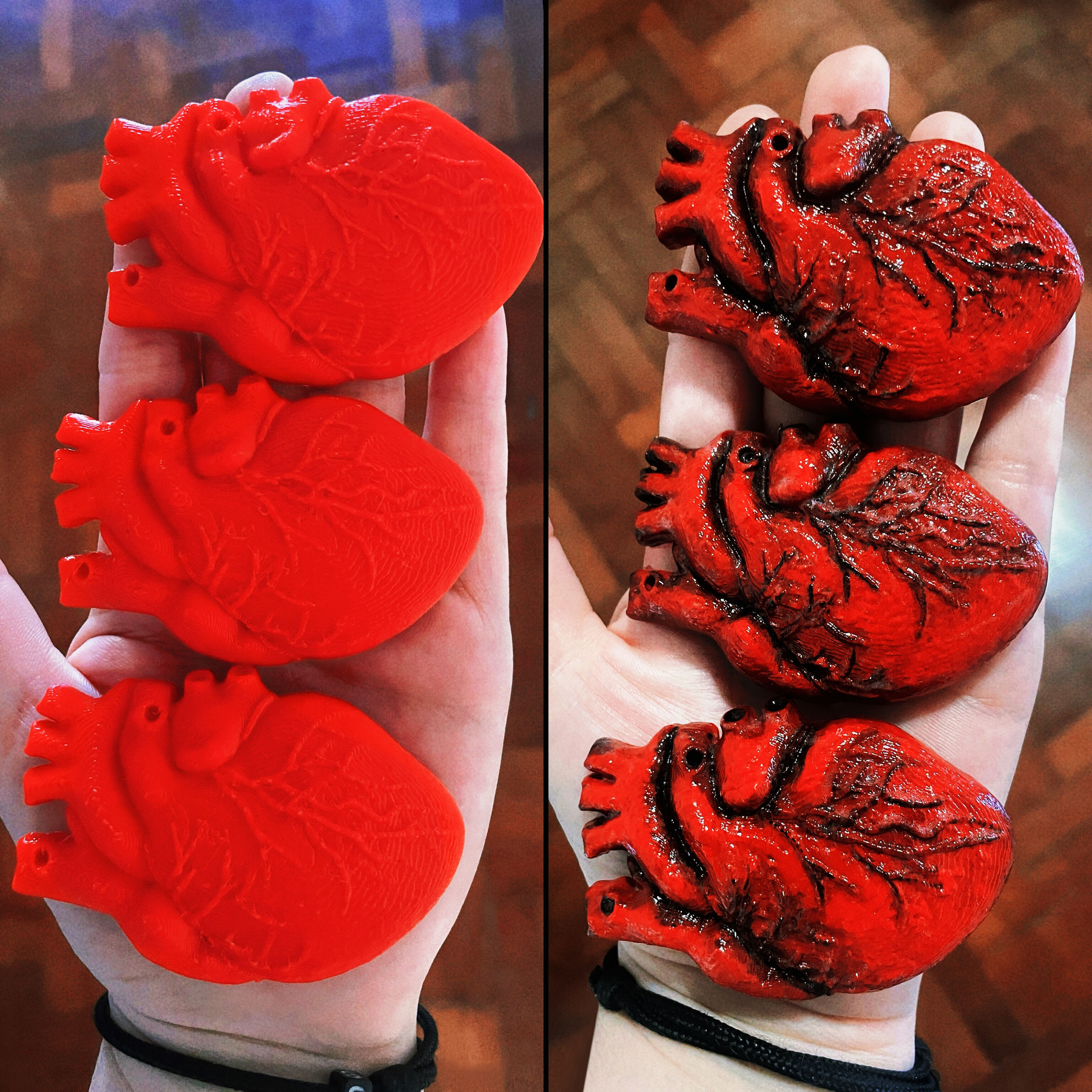 Anatomical Heart in Elegant Baroque Frame 3D print model_8