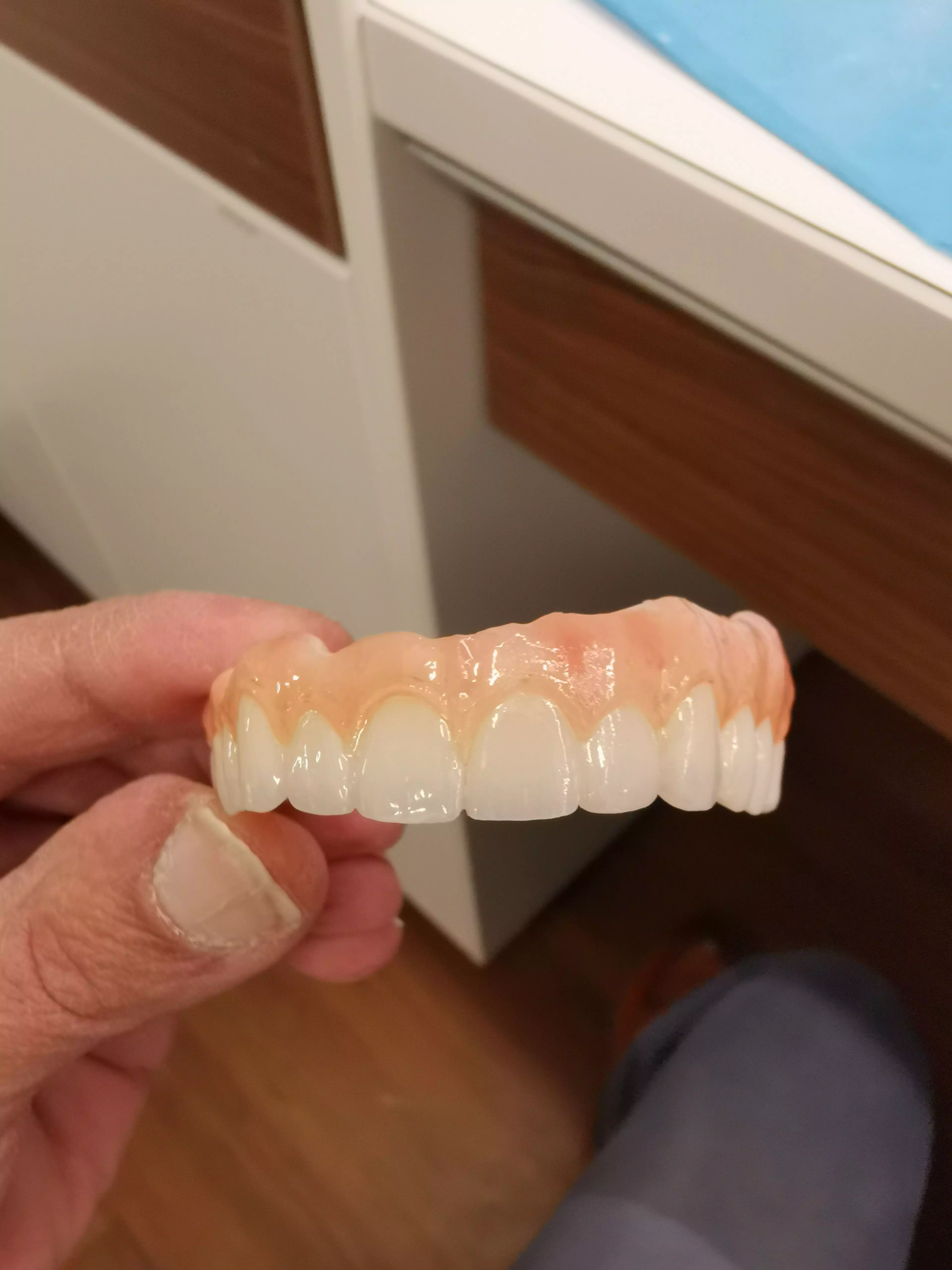  dental PRETTEAU bridge on implant PLEASE  FOLLOW  3D print model_0