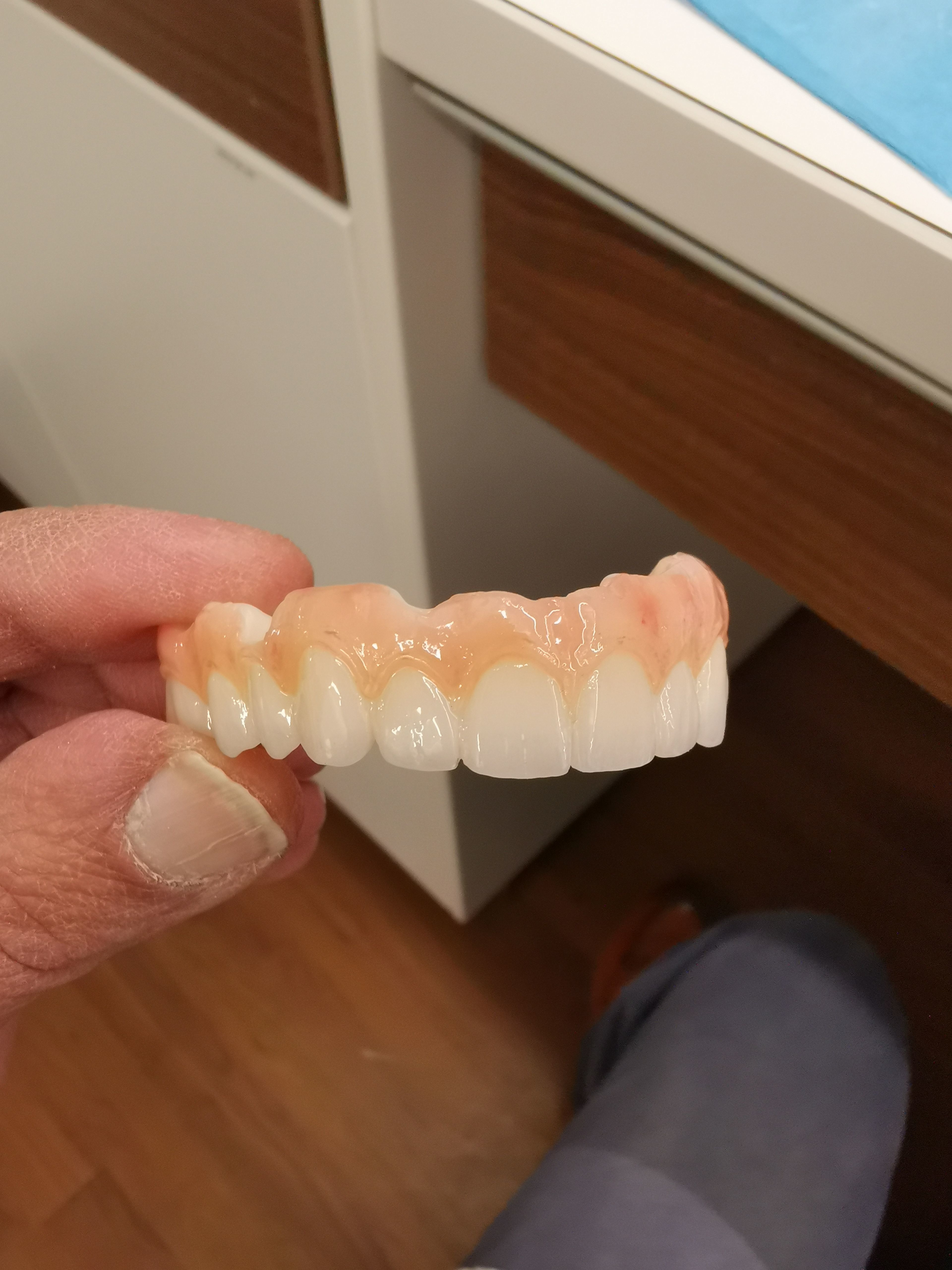  dental PRETTEAU bridge on implant PLEASE  FOLLOW  3D print model_1