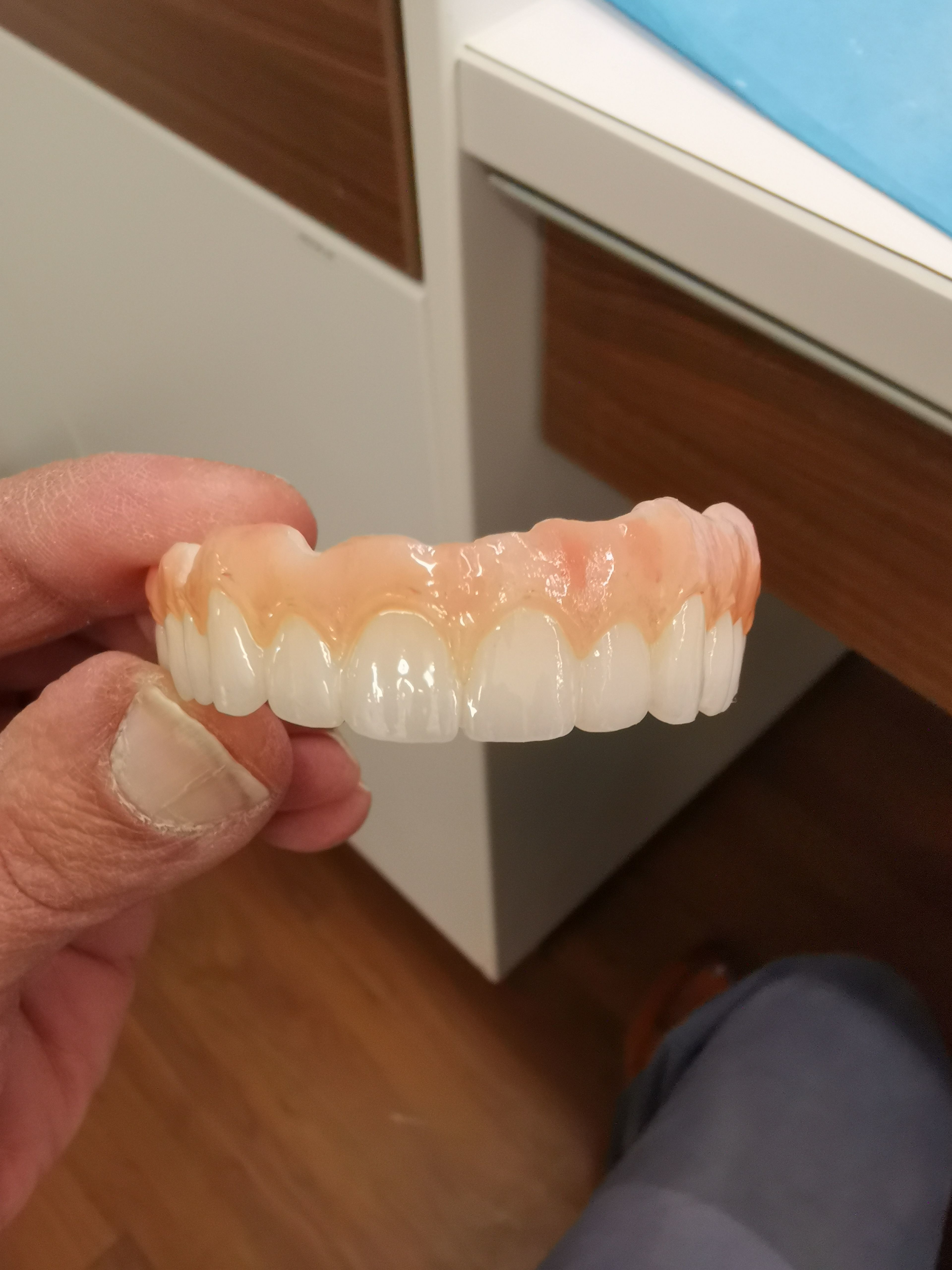  dental PRETTEAU bridge on implant PLEASE  FOLLOW  3D print model_2