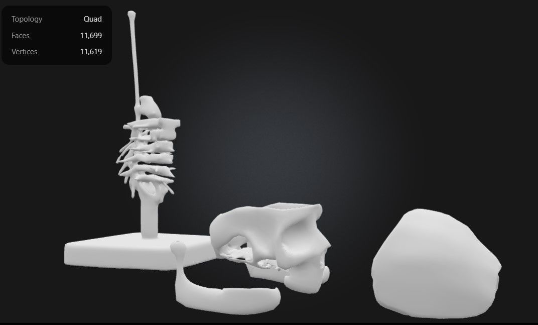 3D Model of Human Skull Anatomy Model On Cervical Spine 3D print model_5