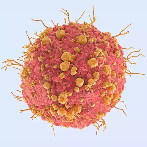 Ovarian Cancer Cell SEM Realistic