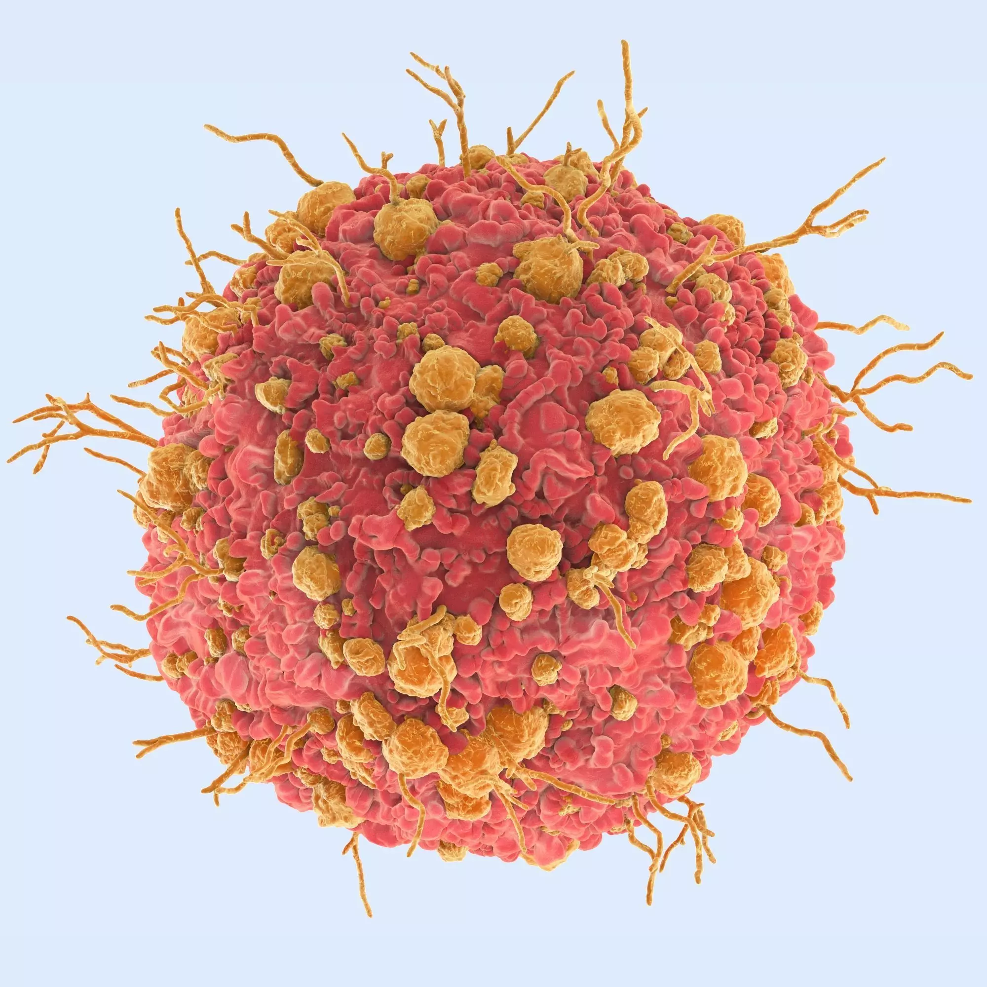 Ovarian Cancer Cell SEM Realistic 3D model