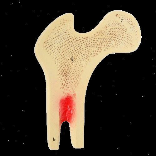Human Bone Microstructure with Long Bone Osteon 3D print model_9