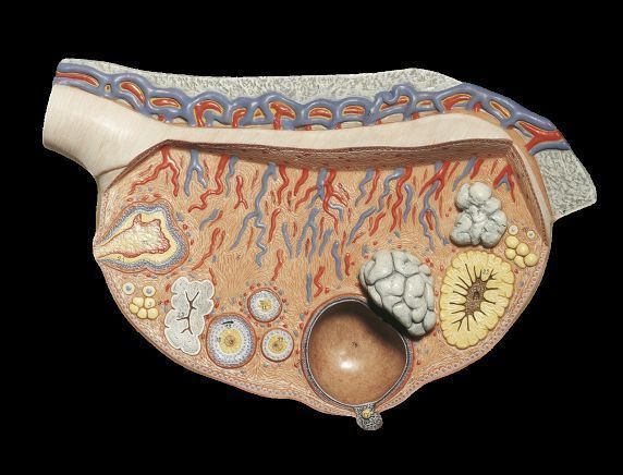 3D Relief Model of the Ovary 3D print model_4