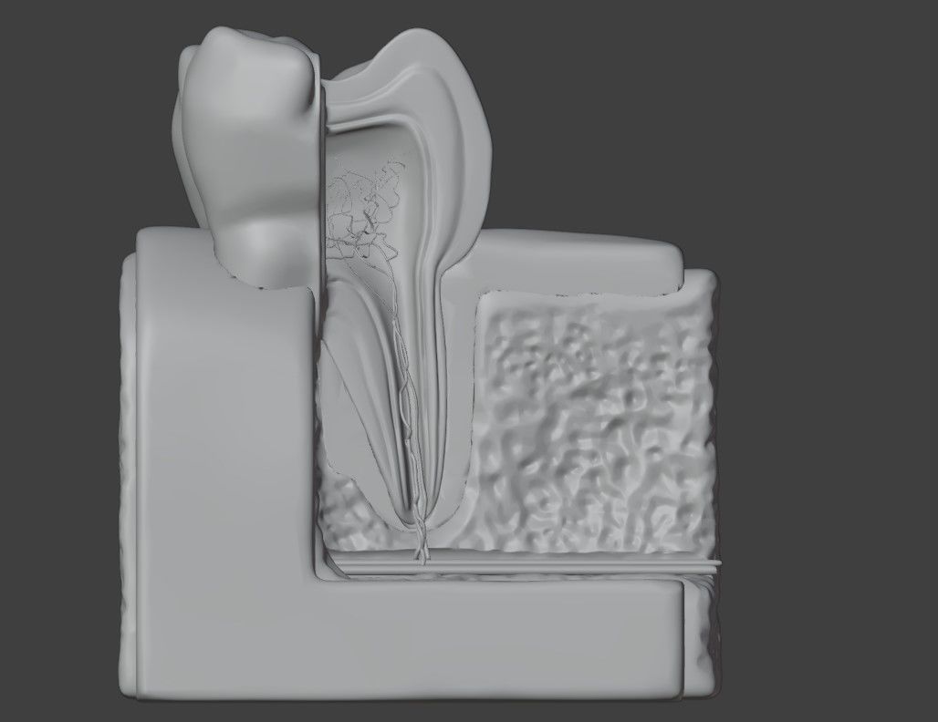 3D Dental Model 3D model_2