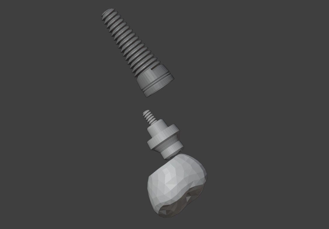 3D Model of Dental Implant 3D model_2