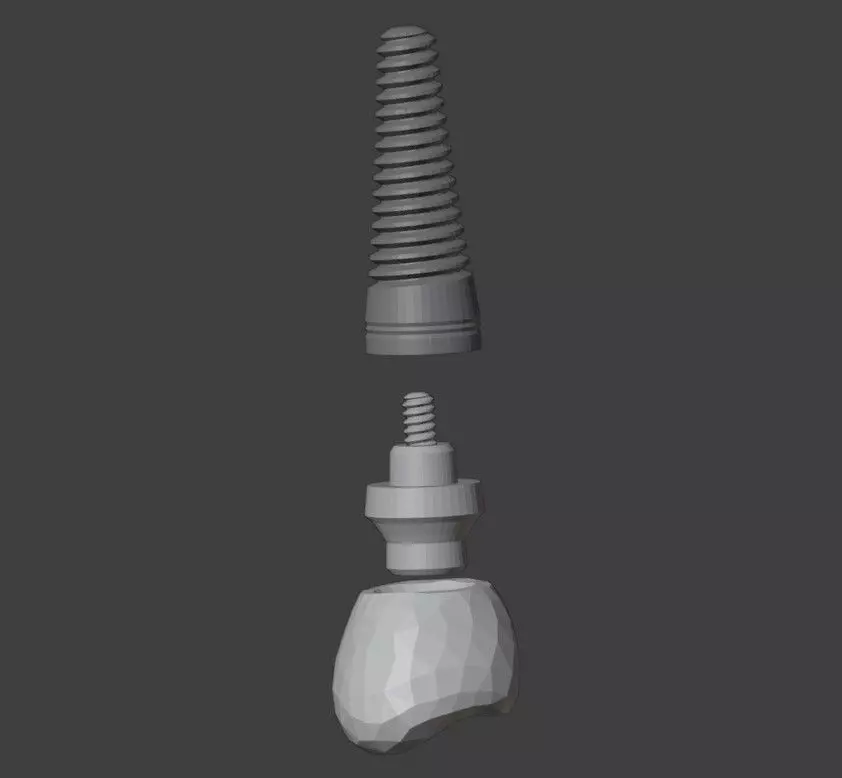 3D Model of Dental Implant 3D model_0
