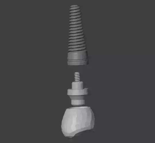 3D Model of Dental Implant