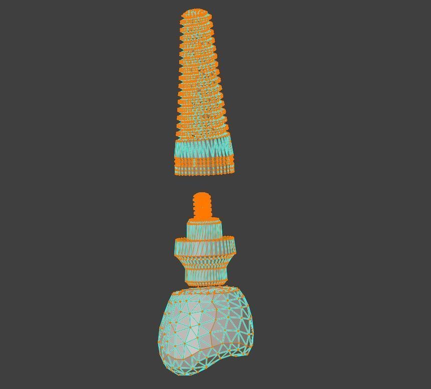 3D Model of Dental Implant 3D model_1