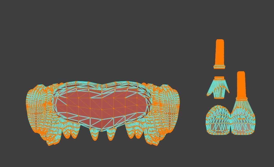 3D Model of Tooth Implants - Dental Model 3D model_7