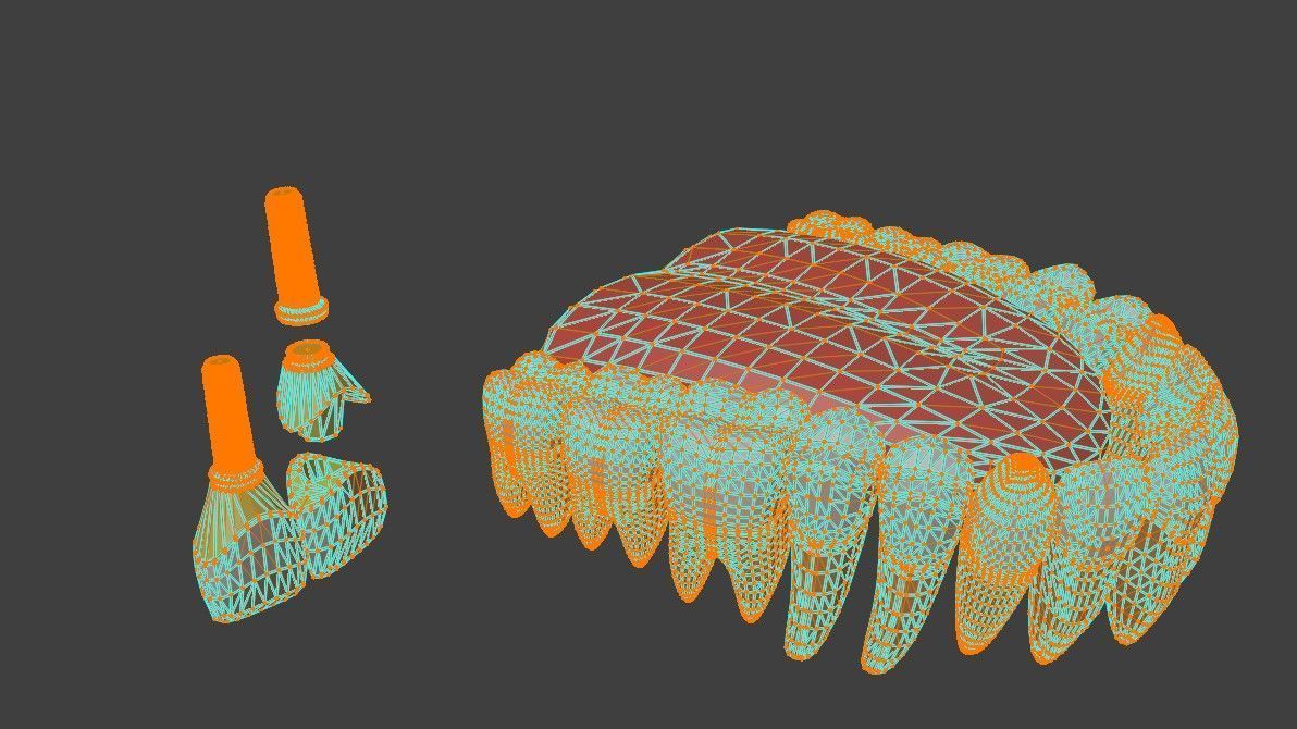 3D Model of Tooth Implants - Dental Model 3D model_1