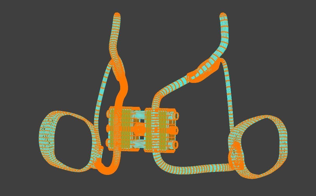 3D Model of Rapid Palatal Expander 3D model_8