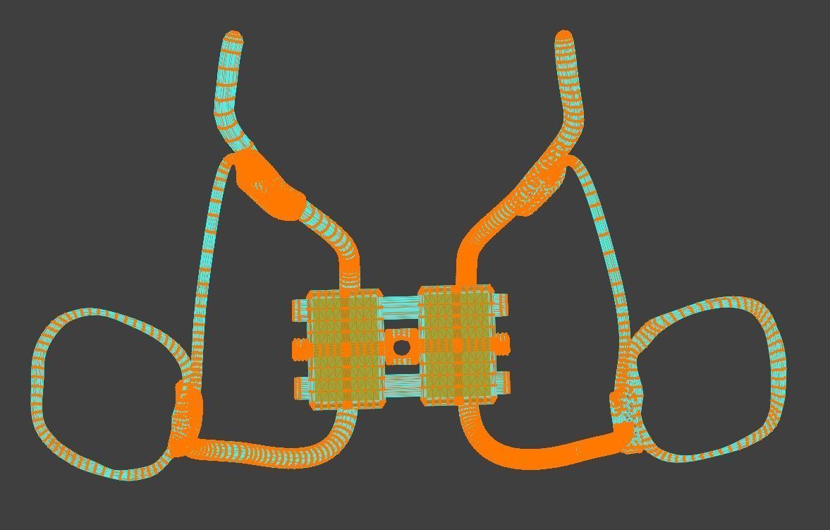 3D Model of Rapid Palatal Expander 3D model_10