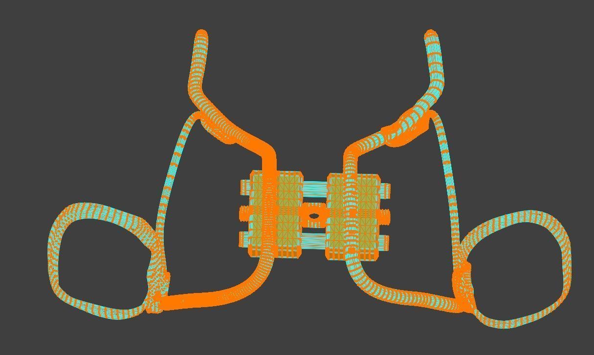 3D Model of Rapid Palatal Expander 3D model_5