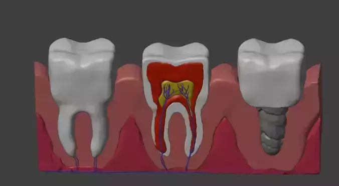 3D Dental Model - Teeth and Gum