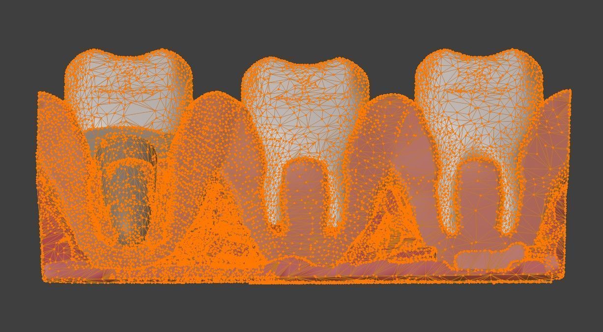 3D Dental Model - Teeth and Gum 3D print model_4