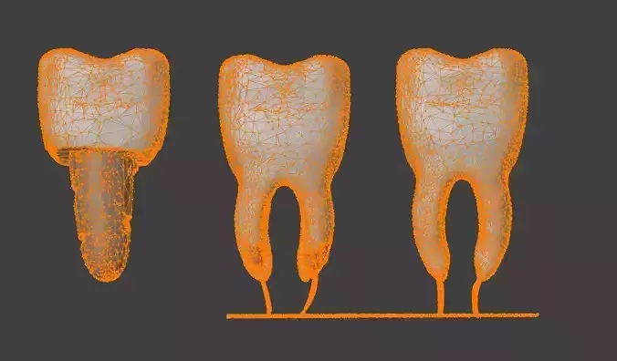  3D Model of Teeth - Dental Model