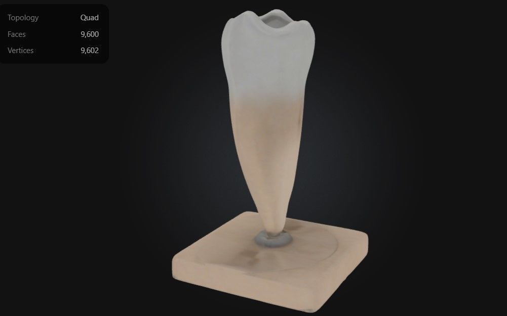 3D Model of Lower Single-Root Pre-Molar Tooth 3D print model_5