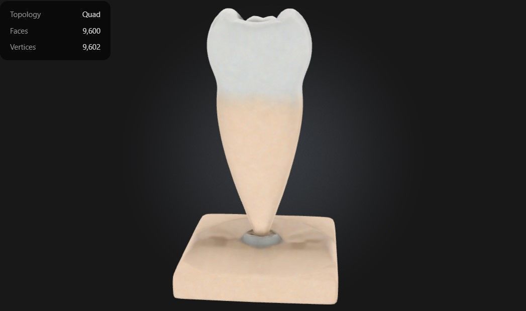 3D Model of Lower Single-Root Pre-Molar Tooth 3D print model_4