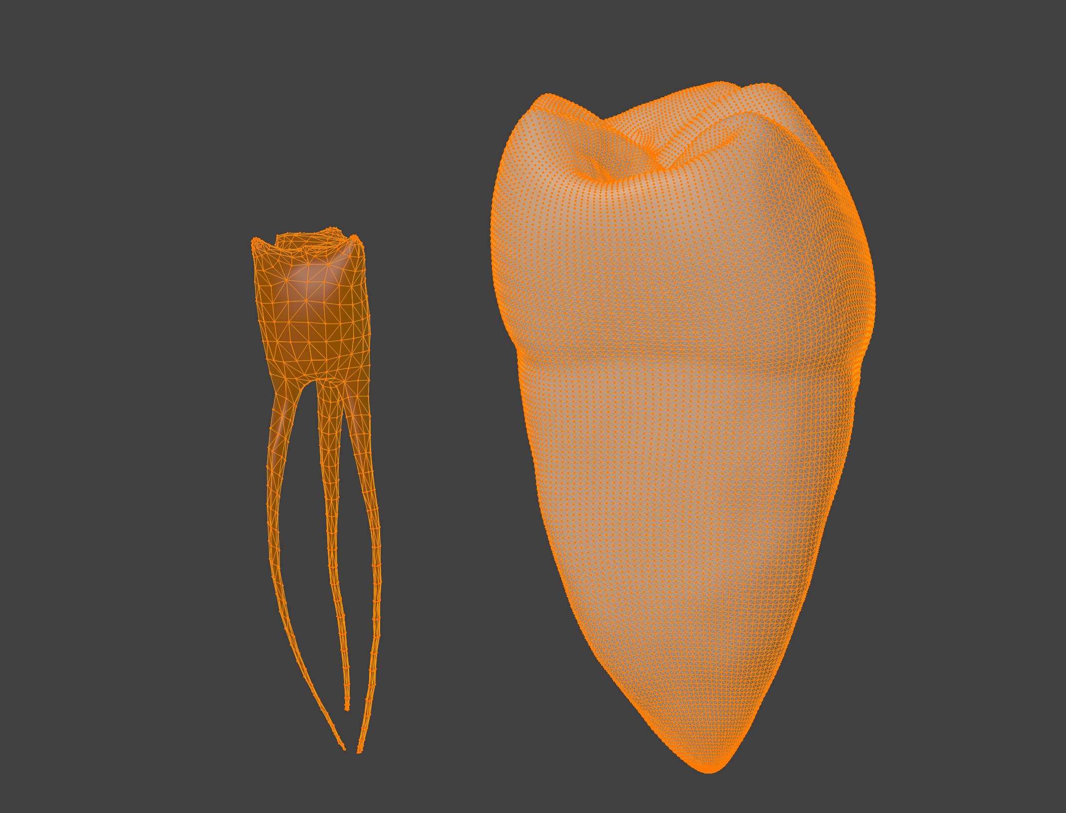 3D Model of Mandibular First Molar Anatomy 3D print model_3