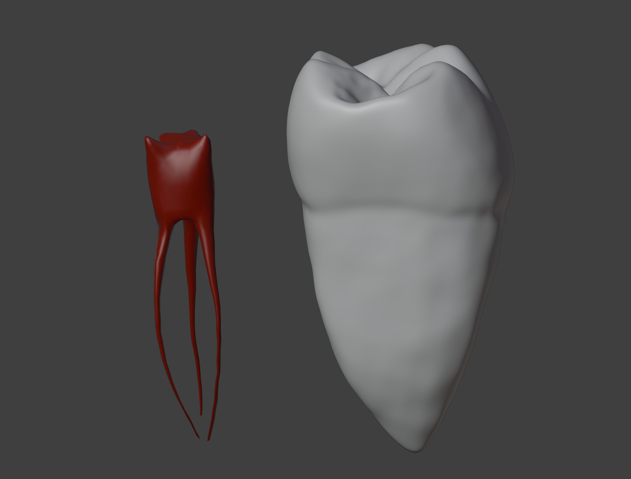 3D Model of Mandibular First Molar Anatomy 3D print model_4
