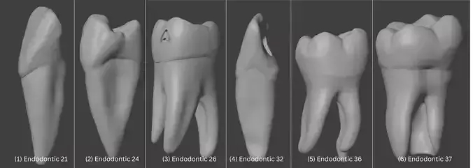 3D Model of Endodontics Bundle - 6 pack 3D print model