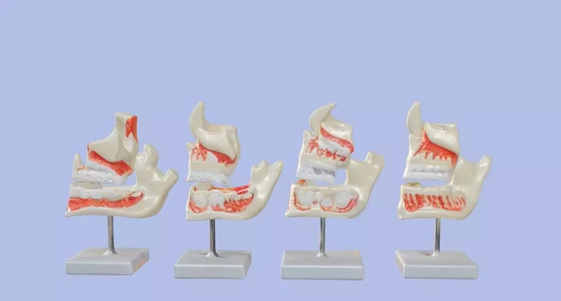 3D Model of Human Dental Development Anatomy 3D print model_0
