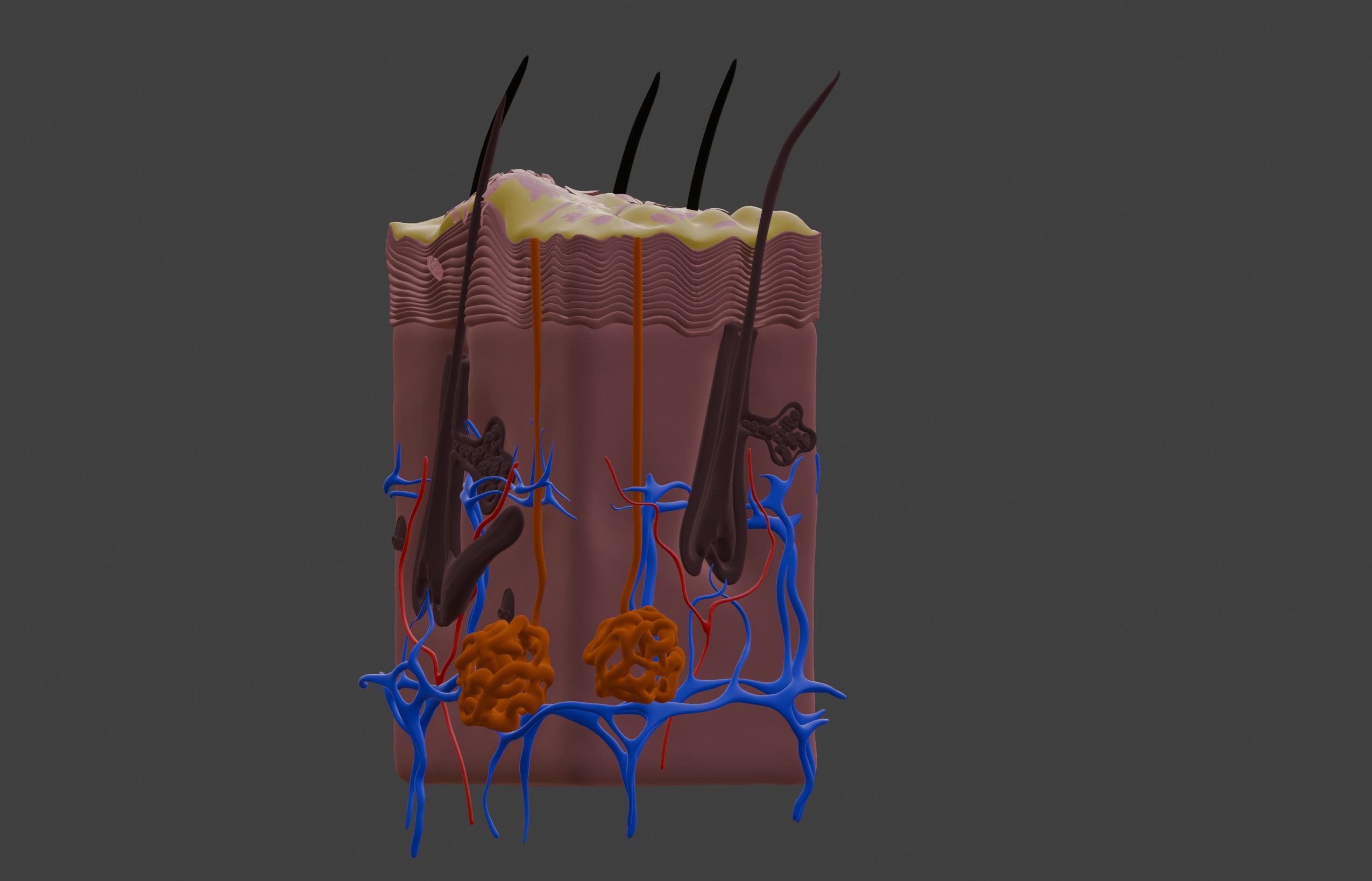 3D Model of Psoriasis Skin - Cross Section 3D print model_5
