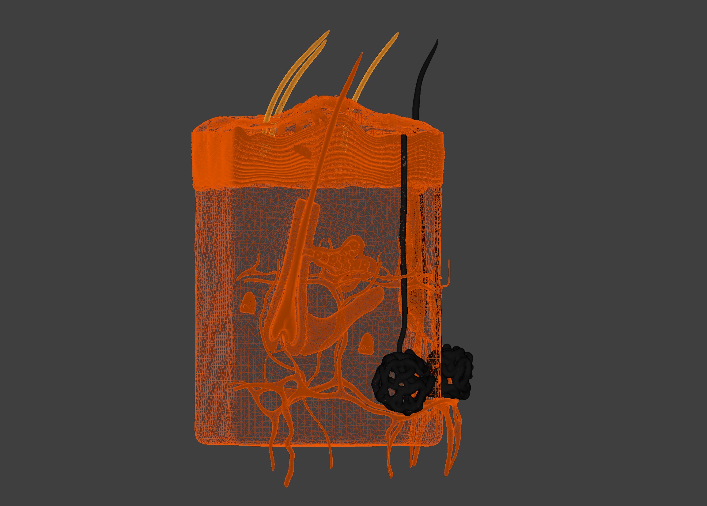 3D Model of Psoriasis Skin - Cross Section 3D print model_1