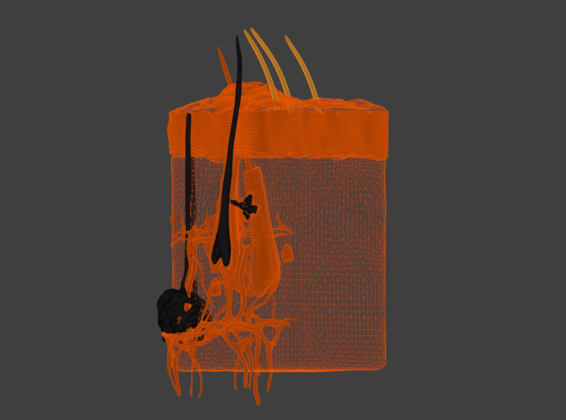 3D Model of Psoriasis Skin - Cross Section 3D print model_3