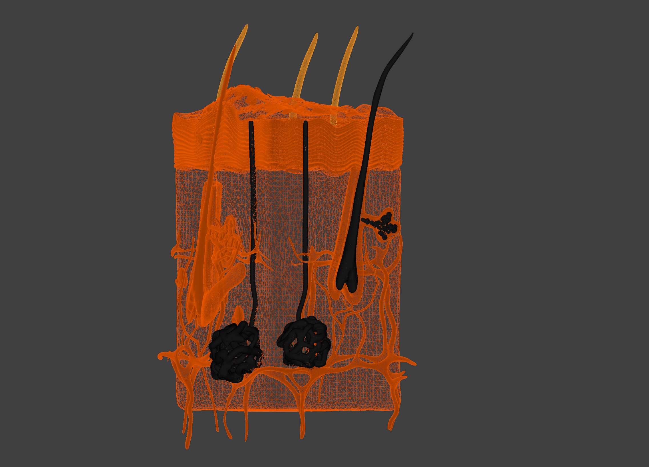 3D Model of Psoriasis Skin - Cross Section 3D print model_2