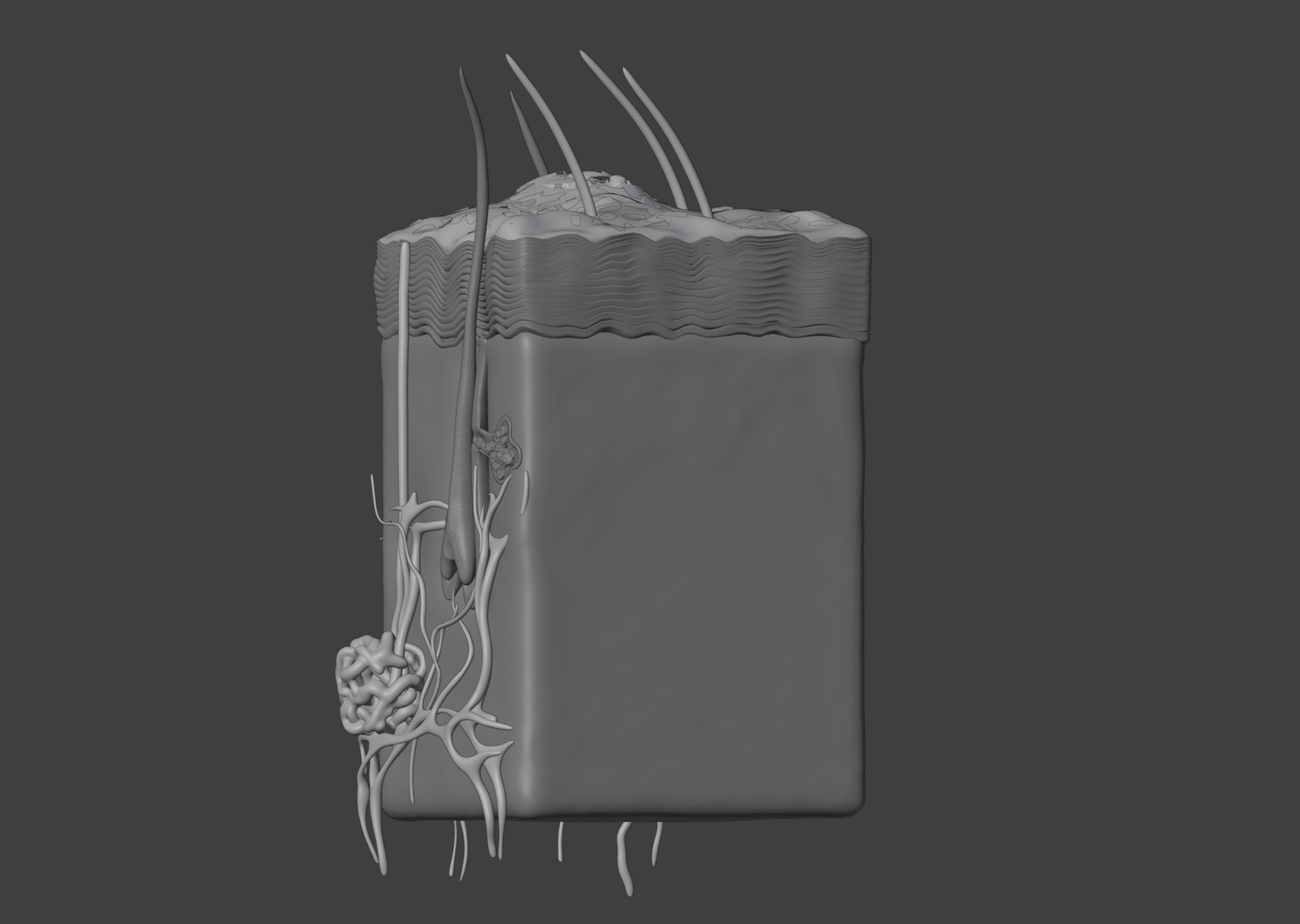 3D Model of Psoriasis Skin - Cross Section 3D print model_10