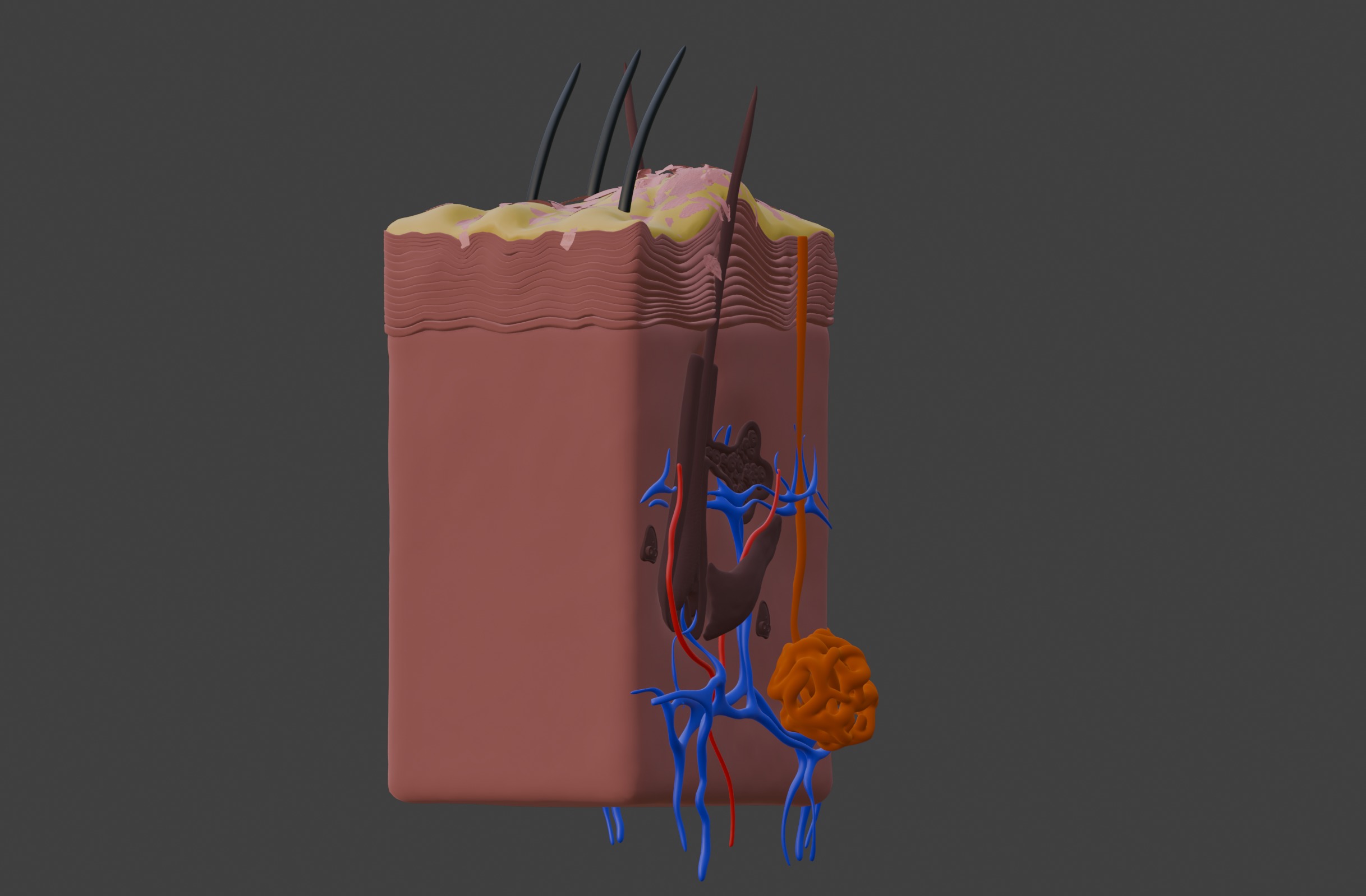 3D Model of Psoriasis Skin - Cross Section 3D print model_8